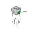 PROMEDICA MEDIFIL - image 1