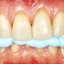 ZHERMACK OCCLUFAST CAD - image 4